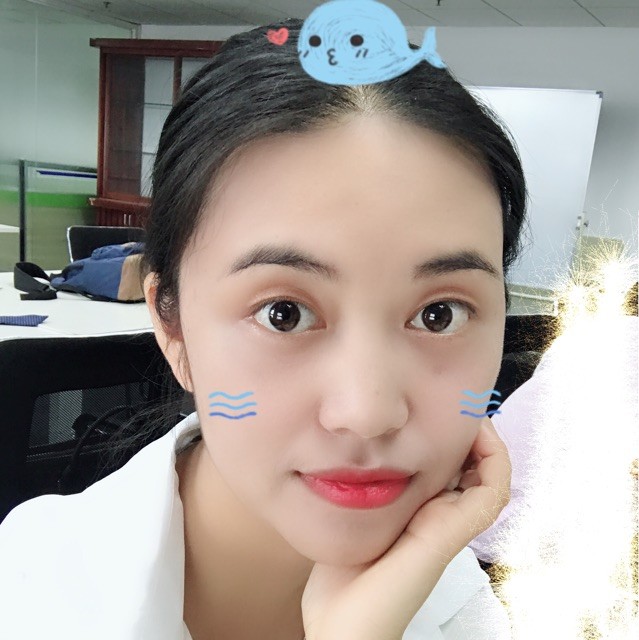 1017154406 左肩上的蝴蝶印