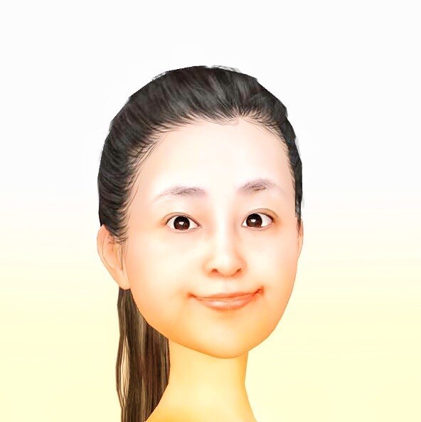 1137888 阿琪