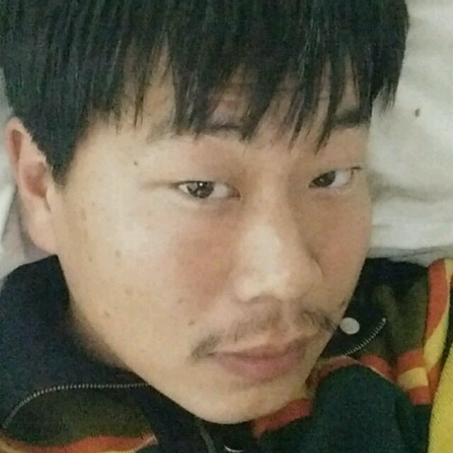 2320048 复杂的单纯人